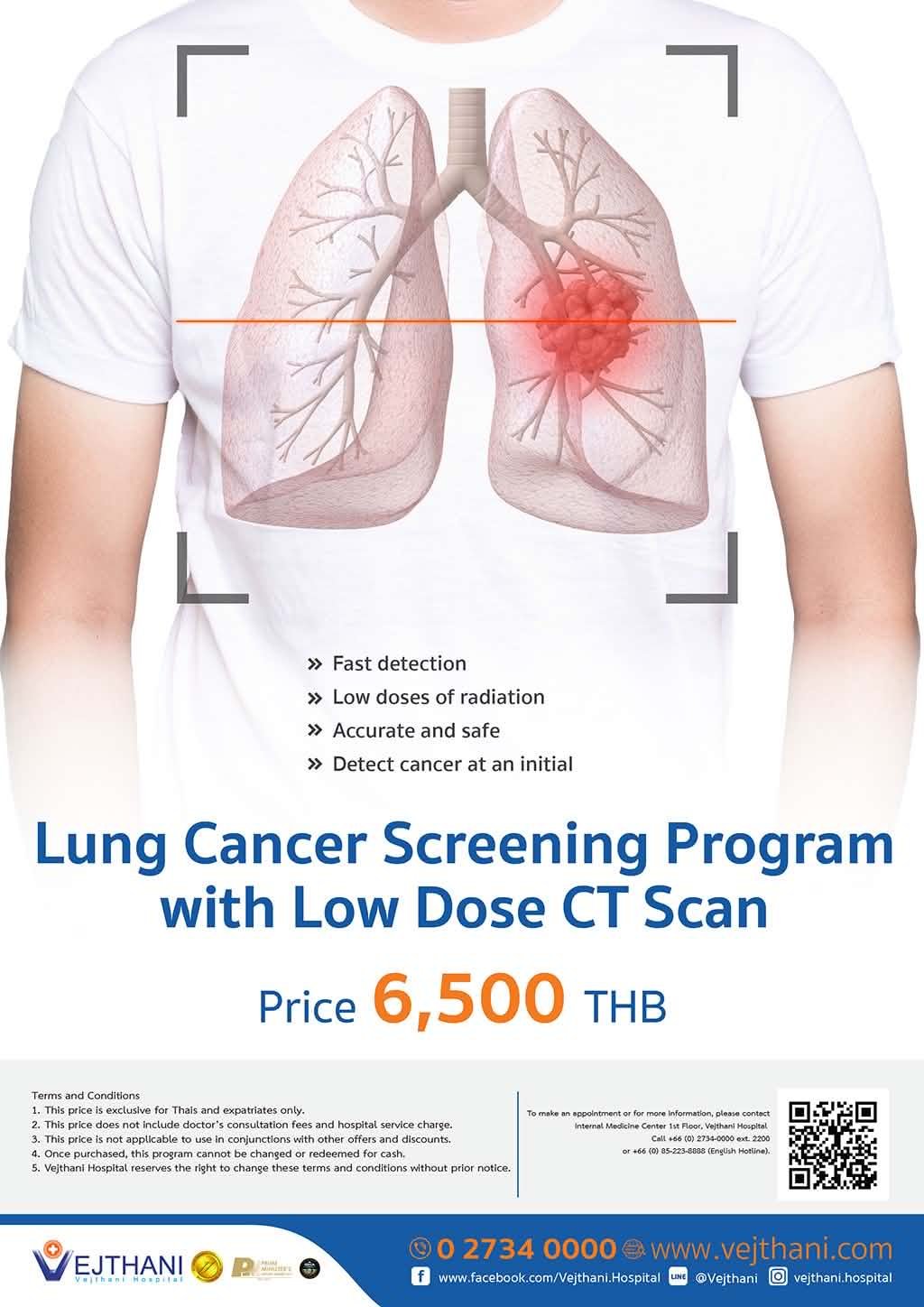 Lung Cancer — Vejthani Hospital